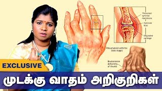 முடக்கு வாதம் அறிகுறிகள் தீர்வு என்ன  arthritis Siddha Treatment  Tamil health tips [upl. by Airehs616]