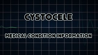 Diagnostic Cystoscopy Model [upl. by Nwadal638]