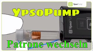 YpsoPump Patrone wechseln Insulinpumpe mylife Diabetescare 08 [upl. by Giusto]