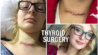 MY THYROID REMOVAL SURGERY  UPDATE [upl. by Oby]