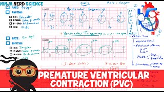 Rate and Rhythm  Premature Ventricular Contraction PVC [upl. by Ellenohs]