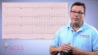 ACLS Mailbox  Adenosine for Ventricular Tachycardia by ACLS Certification Institute [upl. by Imtiaz154]