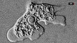 How dangerous are brain eating amoeba [upl. by Neeneg926]