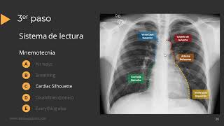 Tutorial Radiografía de Torax [upl. by Atinrahs]