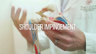 Shoulder Impingement Causes and Treatment [upl. by Booma]