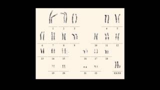 Karyotype notations [upl. by Ahsekahs]