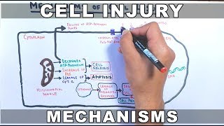 Mechanisms of Cell Injury [upl. by Ylrebmic]