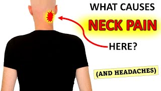 What Causes Upper Neck Pain And Headaches [upl. by Benildas652]