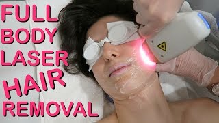 Full Body Laser Hair Removal  Does it Work [upl. by Rehtnug]