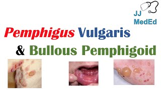 Vesiculobullous Skin Diseases  Pemphigus Vulgaris vs Bullous Pemphigoid [upl. by Southard]