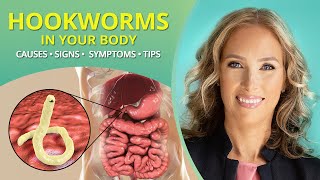 Hookworms  Causes Signs Symptoms amp Tips parasites  Dr J9 Live [upl. by Hatcher]