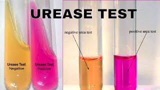 Urea Hydrolysis Urease Test [upl. by Nileve986]