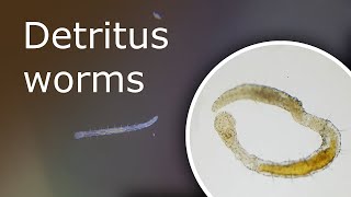 Detritus Worms What Is It and How to Get Rid of Them Detritus Worms Under a Microscope [upl. by Bradman87]