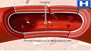 Blood clotting process hemostasis in 3D animation  Blood physiology [upl. by Saxe294]