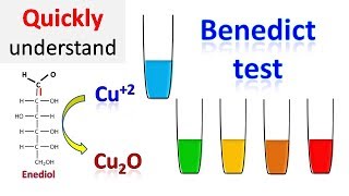 Benedicts test [upl. by Tillinger]