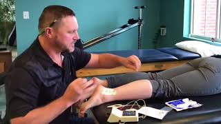 Iontophoresis in Physical Therapy [upl. by Ranice]