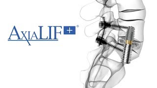 The AxiaLIF® L5S1 Spinal Fusion Procedure [upl. by Alonzo497]