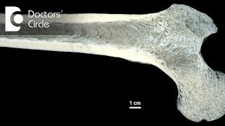 Osteomyelitis clinical features and diagnosis [upl. by Ahselak]