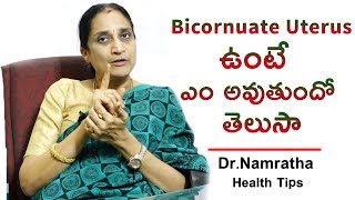 Bicornuate Uterus ఉంటే ఎం అవుతుందో తెలుసా  DrNamratha Health Tips  Health Qube [upl. by Weiler]