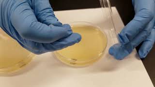 Oxidase Test [upl. by Nerti]