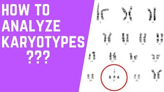 How to Analyze Karyotypes 101 [upl. by Nyltak348]