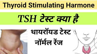 TSH Test in Hindi  Thyroid Stimulating Harmone  tsh report in hindi [upl. by Yraillih268]