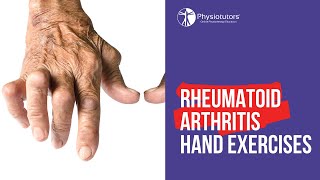 Rheumatoid Arthritis RA Signs amp Symptoms amp Associated Complications [upl. by Nnomae]