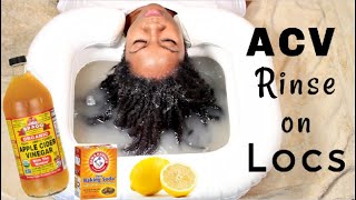 My FIRST ACV Rinse for Locs  Naturally Michy [upl. by Oecam]