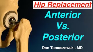 Hip Quadrant Test  Clinical Physio [upl. by Osnola]