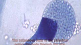 Mucor and Mucormycosis [upl. by Ahsitniuq]