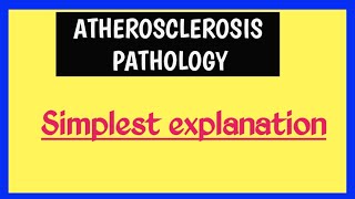 Atherosclerosis  Pathophysiology [upl. by Onaicram989]