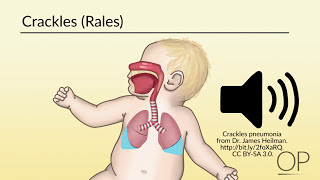 Respiratory Assessment by B Leary L DelSignore  OPENPediatrics [upl. by Whittaker]