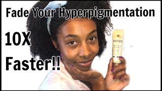 How To REALLY Use Ambi Fade Cream  Fade Hyperpigmentation [upl. by Sven]