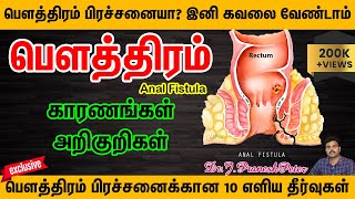 ANAL FISTULAபௌத்திரம்என்றால் என்ன வர காரணங்கள் amp அறிகுறிகள்TIPS amp HOME REMEDIES OF FISTULATAMIL [upl. by Acinod571]