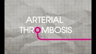 Arterial Thrombosis Explained [upl. by Sullivan]