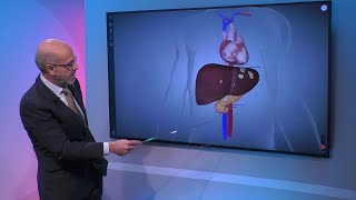 Progression of Metastatic Pancreatic Cancer [upl. by Trinetta]