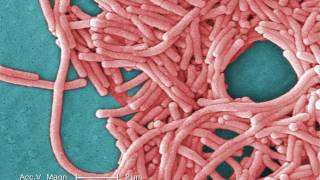 Legionnaires Disease What You Need to Know [upl. by Delamare]