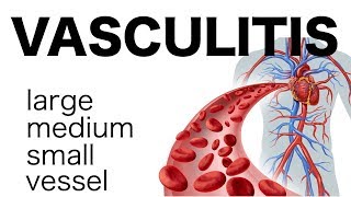 Vasculitis [upl. by Grethel604]