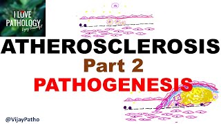 ATHEROSCLEROSIS  Part 2 Pathogenesis [upl. by Enilemme]