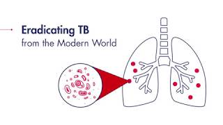 Eradicating TB from the modern world [upl. by Initirb154]