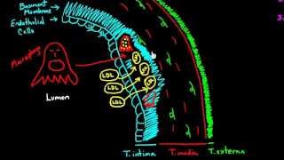 Atherosclerosis  Part 1 [upl. by Ydasahc768]