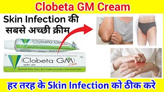 Clobeta gm Cream ll Skin Infection की सबसे अच्छी क्रीम ll Pharma lectures ll [upl. by Ivett280]