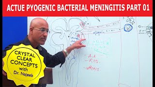 Acute Pyogenic Bacterial Meningitis Part 1 🩺 [upl. by Neeven121]