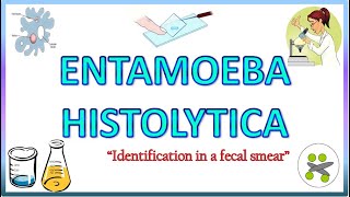 Entamoeba Histolytica  Morphology of the Trophozoite amp Cyst on Light Microscope Stools for AOC [upl. by Padraic]