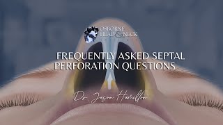 Septal Perforation Frequently Asked Questions by Dr Jason S Hamilton [upl. by Nyvek974]