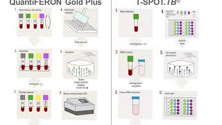 Interferon Gamma Release Assays IGRAs [upl. by Stella]