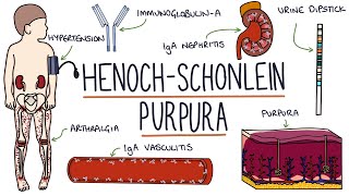 HenochSchonlein Purpura Visual Explanation for Students [upl. by Aernda675]