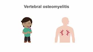 Osteomyelitis  Symptoms amp Causes🩺 [upl. by Clary242]