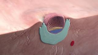 Implantation of the blastocyst [upl. by Tiduj723]