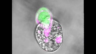 An amoeba eating a human cell [upl. by Nohsar]